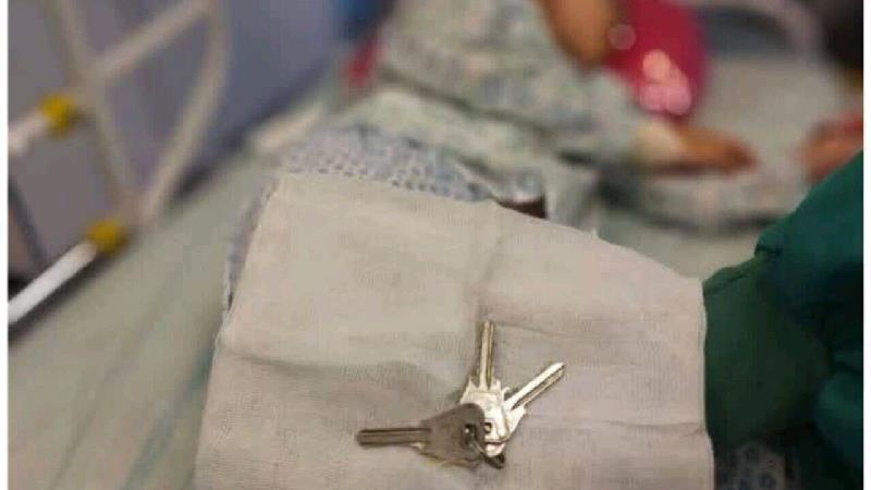 خارج کردن دسته کلید از معده کودک ۶ ساله سبزواری