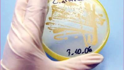 دلایل اصلی ابتلا به عفونت های زنانه چیست