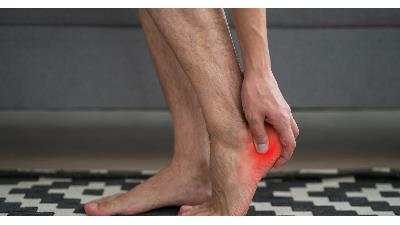 ویژگی بهترین دکتر میخچه در تهران