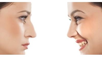 آیا جراحی بینی زیر 18 سال ضرر دارد؟