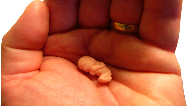 عوارض سقط جنین عمدی برای زنان