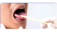 نشانه‌ها و علائم سرطان زبان ؛ از بوی بد دهان تا زخم و درد