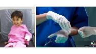 مرگ کودک اروندکناری هنگام جراحی دست