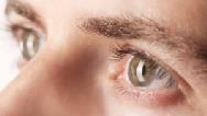 علت خشکی چشم چیست و چه درمان هایی دارد؟