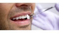 فاصله بین دندان ها چه دلایلی دارد