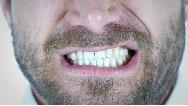 دلایل دندان قروچه در خواب و راه های پیشگیری