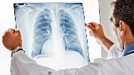 سندروم زجر تنفسی چیست؛ دلایل و راه درمان
