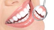 کامپوزیت دندان چگونه است؛ مزایا و معایت و روش انجام