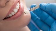 لمینت دندان چه عوارض و ضررهایی دارد