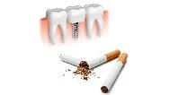 تاثیر سیگار در میزان موفقیت ایمپلنت دندان