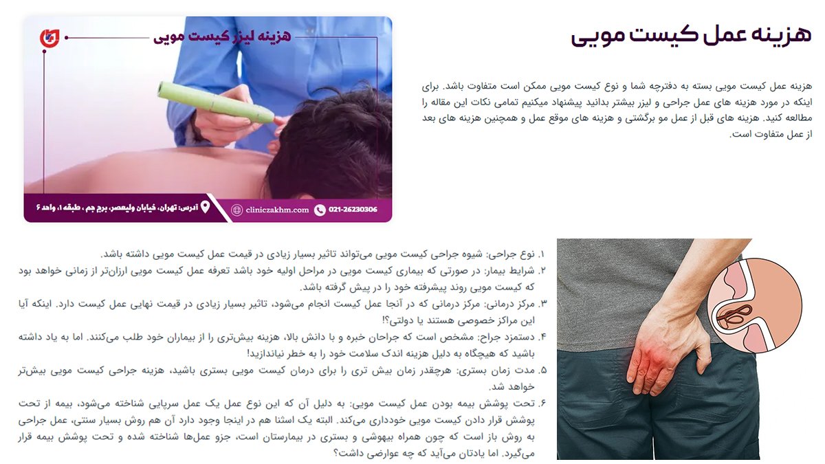 هزینه عمل کیست مویی چقدر است؟