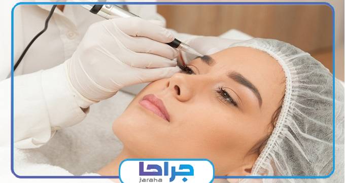 عوارض کاشت ابرو