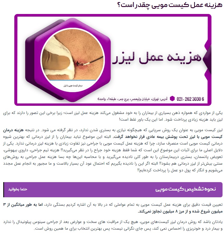 هزینه درمان کیست مویی