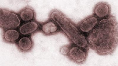 آیا ویروس زامبی واقعا خطرناک است